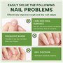 Stylos à Huile pour Cuticules Nail Nutrition Oil Soin