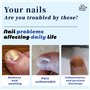 Correction Ongles Incarnés en Plas
