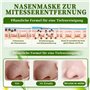 Extracteur de points noirs, élimine les points noirs pour le visage, pour hydrater, nettoyer en profondeur la peau et le visage 