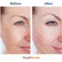 LyfNeeds Rouleau de massage en silicone réutilisable pour le visage, les yeux et le cou - Soin de la peau - Vert