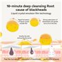 LANBENA Blackhead Remover - Masque pour le nez et le visage, Kit d'élimination de la tête noire avec LANBENA - 1.05oz
