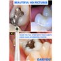 DARYOU DY-60 Intraoral Camera caméra Intra-orale intraorale caméra Dentaire 720P HD Dental Camera.Button Fonctionne Vraiment dan