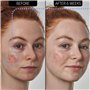 The Inkey List | Azelaic Acid 10% Serum | Supersolutions | 30ml