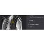 PIRELLI PIRELLI 120/70 ZR17 58W ANGEL ST TL - 70/70/R17 58W - A/A/70dB - Moto Pneu