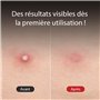 [MIZON] GOOD BYE BLEMISH CLEAR PATCH (x44) Korean Skincare - Patchs Anti-Imperfections ultra discrets & ultra fins - Soin Apaisa