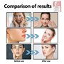 5PCS Bio Collagen Face Mask Overnight,Bio-Collagen Real Deep Mask,Bio-Collagen Deep Hydrating Overnight Mask,Film de collagène H