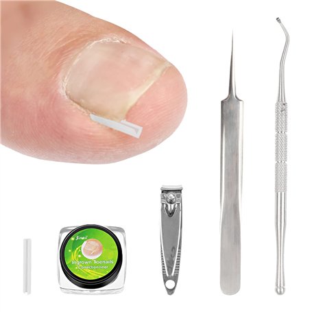 Kit Ongles Incarnés