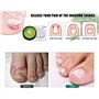 Kit Ongles Incarnés,Ongle Incarné Orteil Kit de traitement de correction des ongles incarnés, 50 tampons de remplissage pour ong