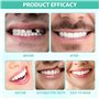 ProthèSe Dentaire Silicone Dentier Provisoire Facette Dentaire Prothese Dentaire Silicone Appareil Dentaire En Silicone ProthèSe