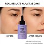Sérum Anti-Tâche Visage Suquato - acide tranexamique, Vitamine C & Niacinamide - Réduction des Tâches Brunes, Hydratation Intens