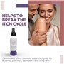 Derma Treat Traitement Psoriasis et Eczema I Soin Naturel, calme le Psoriasis de la Peau et du Cuir Chevelu I Traitement pour Pe