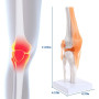 Asyduey Articulation Anatomique Du Genou avec ModèLe de Ligaments, Humaine 1:1, Pour L'éTude en Classe de Sciences, Enseignement