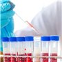 RéCipient de Test de Laboratoire Gradué et Marques D'