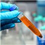 Pvczool Tubes à Centrifuger Coniques 100 PièCes 15 ML avec Bouchons à Vis, RéCipient de Test de Laboratoire Gradué et Marques D'