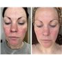 STYPRO Masque facial à LED à longueur d'onde – Soin de la peau multi-mode avec lumière rouge, bleue, proche infrarouge pour les 