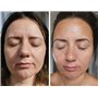STYPRO Masque facial à LED à longueur d'onde – Soin de la peau multi-mode avec lumière rouge, bleue, proche infrarouge pour les 