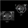 Vintree Couvre Volant en Microfibre Souple sur Le Volant de la Voiture avec Aiguille et Fil Accessoires intérieurs Universal Lea