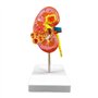 Modèle d'anatomie 4D Modèle d'anatomie du Rein Humain Modèle d'enseignement Organes Humains Modèle de Rein Malade Modèle de Corp