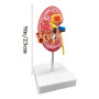 Modèle d'anatomie 4D Modèle d'anatomie du Rein Humain Modèle d'enseignement Organes Humains Modèle de Rein Malade Modèle de Corp