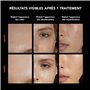 FAQ 202 Masque luminothérapie visage Anti-âge NIR+7 LED | Soin pour le visage localisé et traitement de l'acné | Masques de beau