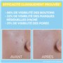 GARNIER SkinActive - Fluide Anti-UV Matifiant & Anti-Imperfections Quotidien - SPF 50+ - Protège & Réduit les Imperfections - En