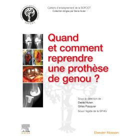 Quand et comment reprendre une prothèse de genou ?