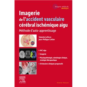 Imagerie de l'accident vasculaire cérébral ischémique aigu