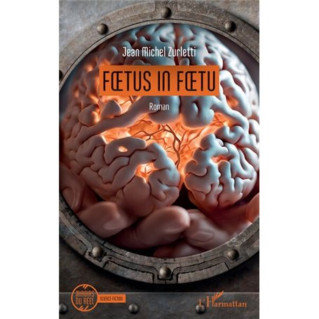 Foetus in foetu