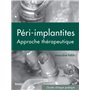 LES PÉRI-IMPLANTITES