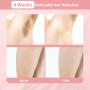 Épilation Laser pour Femmes et Hommes, Appareil D'épilation IPL 3 en 1 pour Tout le Corps, Indolore, Sûr, Convient aux Salons de