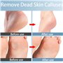 2 in 1 Lime à Pieds en Verre,Lime Pieds en Nano Verre Râpe anti-callosités 2 en 1 Nano Glass Utilisé pour Les Soin des Pieds à D