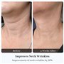 Appareil Anti Rides Visage, 3 Modes EMS Appareil de Gua Sha Visage, Chauffable 45°C Guasha Pour Visage Instrument, Raffermisseme