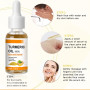 Horuili® Sérum Correcteur de Taches au Curcuma, Sérum Anti-Oxydant au Curcuma Pour Éclaircir La Peau, Huile Faciale au Essentiel