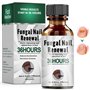 30ml Soins Pour Les Ongles