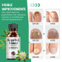 30ml Soins Pour Les Ongles, Réparateurs et nourrissants Ongles, Soin Ongles Pied et Main, Avec Pinceau Applicateur+Lime à Ongles
