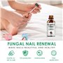 30ml Soins Pour Les Ongles, Réparateurs et nourrissants Ongles, Soin Ongles Pied et Main, Avec Pinceau Applicateur+Lime à Ongles