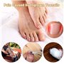 Lot de 50 patchs de correction des ongles incarnés sans colle pour ongles d'orteils pour soins des pieds, autocollants de correc
