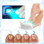 Appareil Traitement Laser Mycose Ongles, Appareil Anti Mycose, Ongles des Pieds et des Mains Dispositif, Minuterie Numérique, Ou
