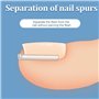 WOLMIK Lot de 40 correcteurs d'ongles incarnés sans douleur avec rehausseur d'ongles incarnés - Kit d'outils faciles à utiliser