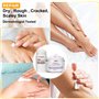 Crème à l'urée 40% crème à l'urée 42% plus 2% acide salicylique force maximale pour les pieds talons craquelés pieds genoux coud