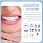 Kit Strass Dentaire,Kit Strass Dentaire Professionnel,Bijoux Dentaire Gemmes pour Décoration de Dents De Ongles,Colle Strass Den