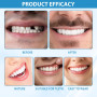2 Pcs ProthèSe Dentaire Silicone Dentier Provisoire Facette Dentaire Prothese Dentaire Silicone Appareil Dentaire En Silicone Pr