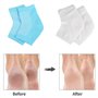 FUZVOL Lot de 2 paires de chaussettes hydratantes pour homme et femme, chaussettes en coton doux à bout ouvert, chaussettes en g