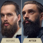 Striking Viking Huile à barbe pour hommes – Formule biologique naturelle avec huiles d'arbre à thé, d'argan et de jojoba pour ho