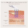 Blue LED+ Acne Light Therapy de Project E Beauty | Anti-acné | Réduit les Taches | Calme l'Inflammation et la Peau Sensible | En
