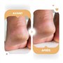 8% - Set Crème Pieds et Mains Hydratantes et Réparatrices - Kombucha, Acide Hyaluronique et Niacinamide - Tous types de peau - S