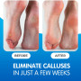 Imperial Feet Masque exfoliant Pieds - Chaussettes exfoliantes pour callosités et peeling pieds - Efficace pour les peaux mortes