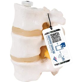 3B Scientific® Modèle de 3 Vertèbres Lombaires – Segment Vertébral Taille Réelle avec Disques Intervertébraux