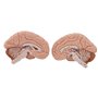 3B Scientific® Tête Taille Réelle – Modèle Humain en 5 Parties avec Muscles, Nerfs, Vaisseaux & Cerveau Amovible + Smart Anatomy