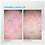 UREADIN Lotions de Massage